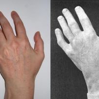 Janina's left hand and Chopin's left hand